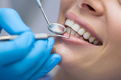 Dental Concepts | Dental Fillings, Periodontal Treatment and Oral Cancer Screening