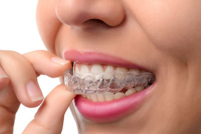Dental Concepts | Juvederm reg , Oral Exams and Dentures