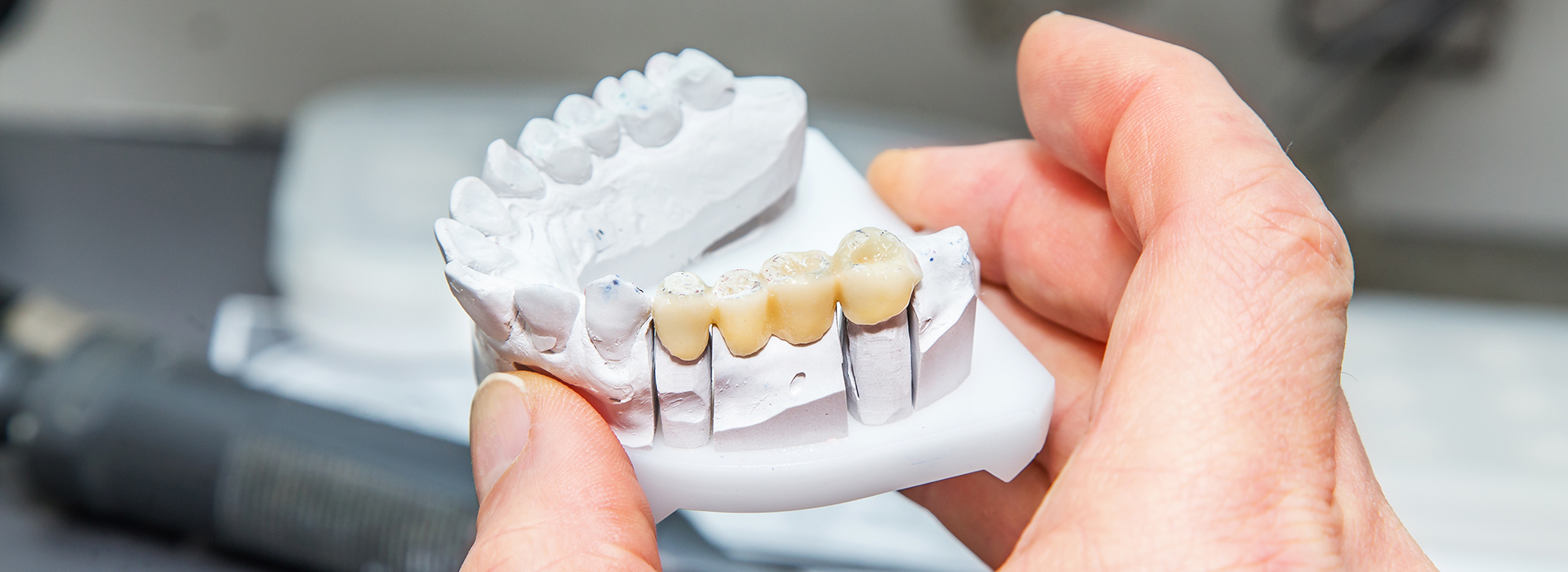 Dental Concepts | Preventative Program, Smile Makeover and Dentures