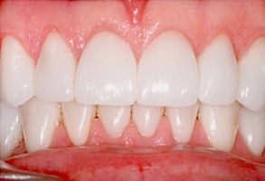 Dental Concepts | Digital Radiography, Smile Makeover and Veneers