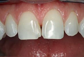 Dental Concepts | Sports Mouthguards, Periodontal Treatment and All-on-4 reg